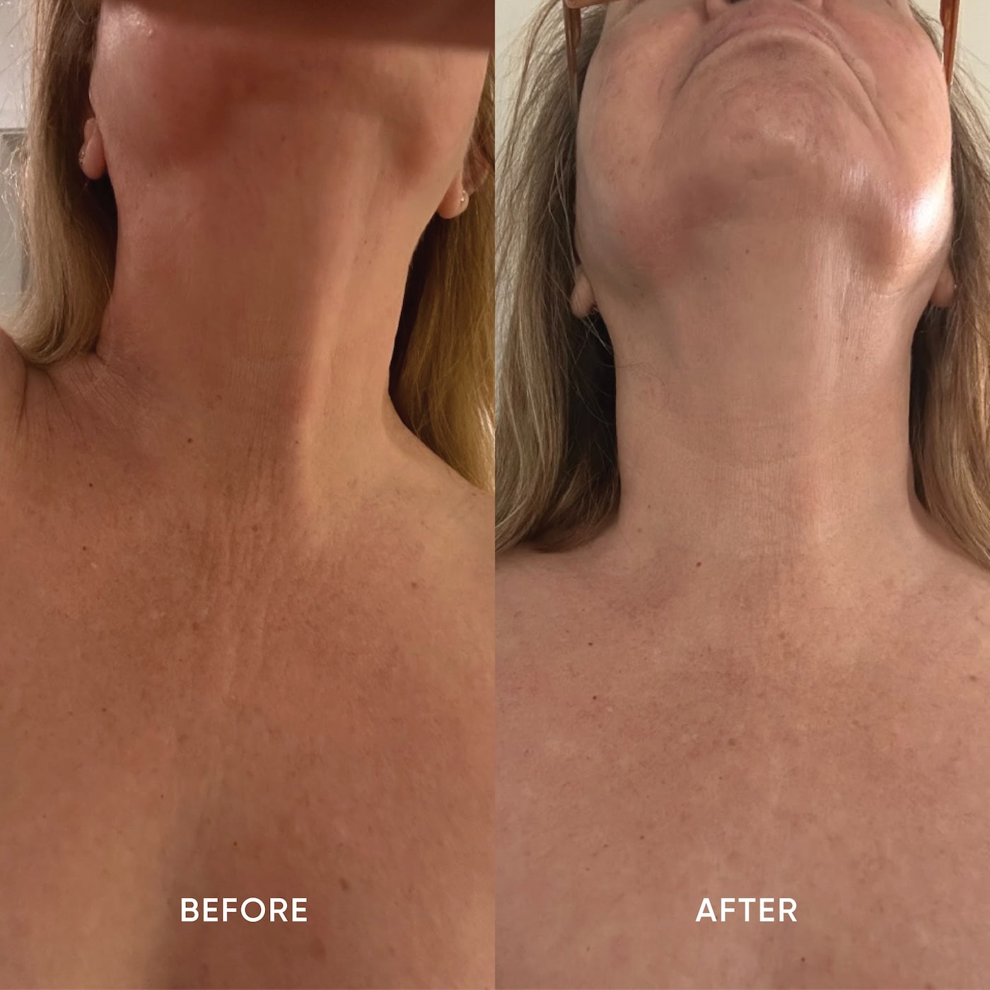 Firming Neck Cream