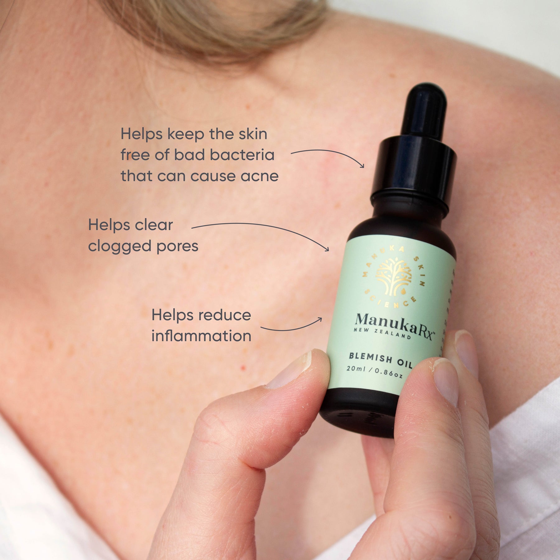 ManukaRx Blemish Oil product benefits