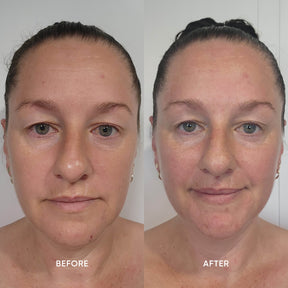 Before and after images from using ManukaRx Nourishing Night Cream