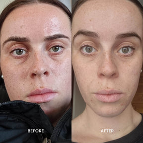 ManukaRx Soothing Cream Cleanser consumer before and after use images