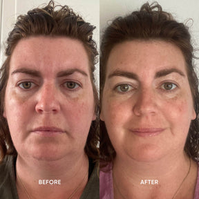 ManukaRx Vitamin C Brightening Eye Cream Before and After customer photos