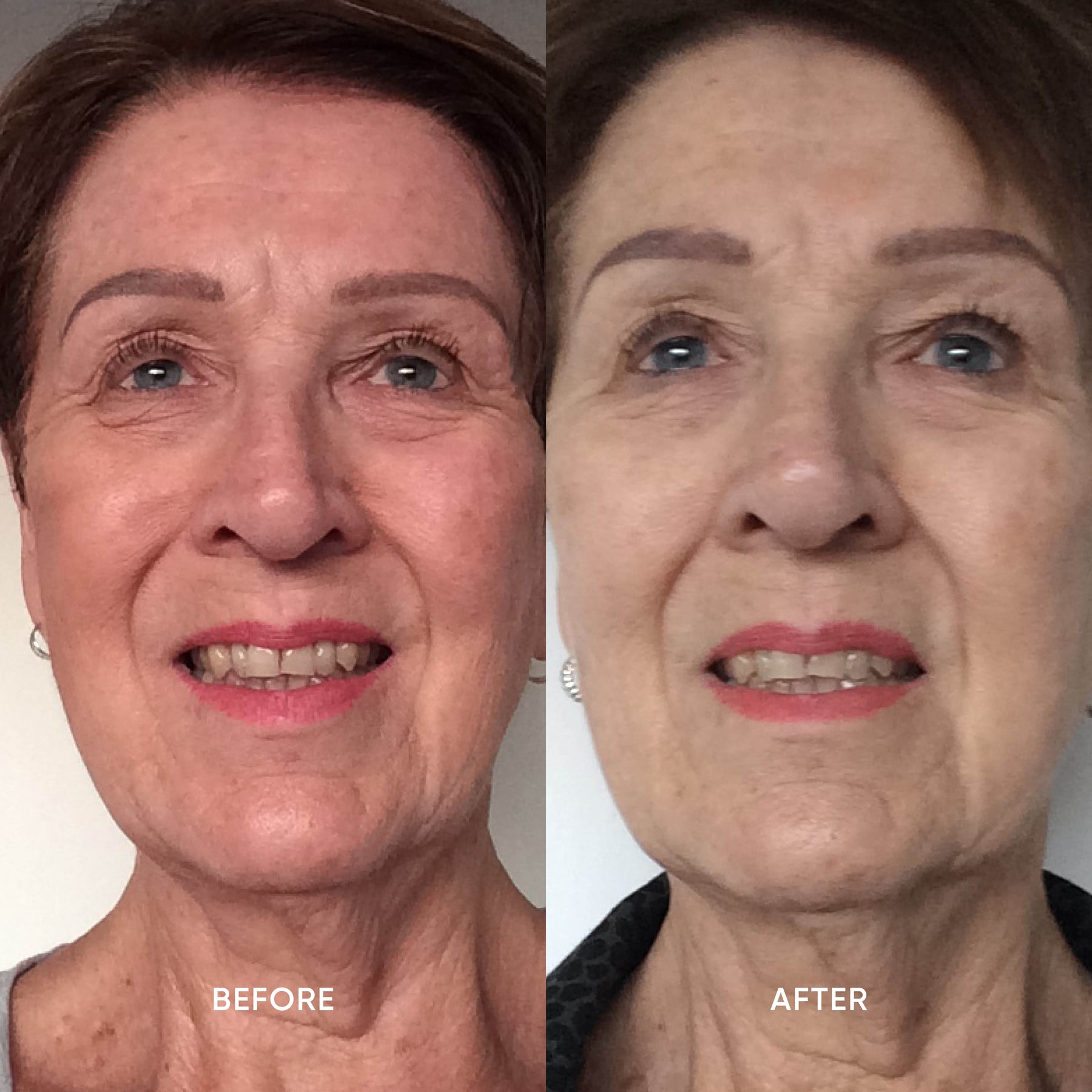 ManukaRx Vitamin C Daily Glow Brightening Cream customer side by side before and after results photos